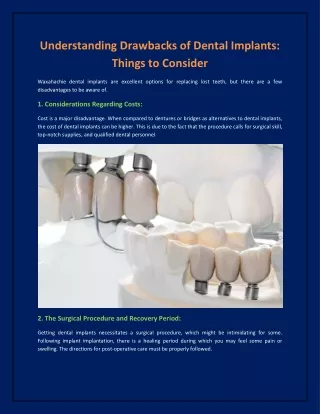 Understanding Drawbacks of Dental Implants - Things to Consider