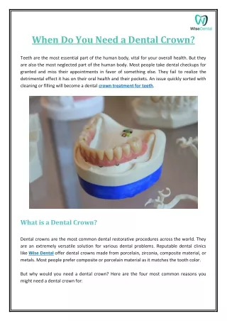 4 Reasons to Choose Dental Crown Treatment