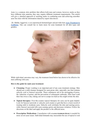 Best Acne Treatments for Men- Skin Expert Insights