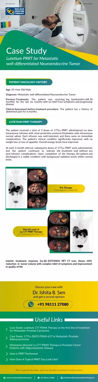 Revolutionizing Prostate Cancer Treatment Lutetium-177 PSMA Therapy Case Study