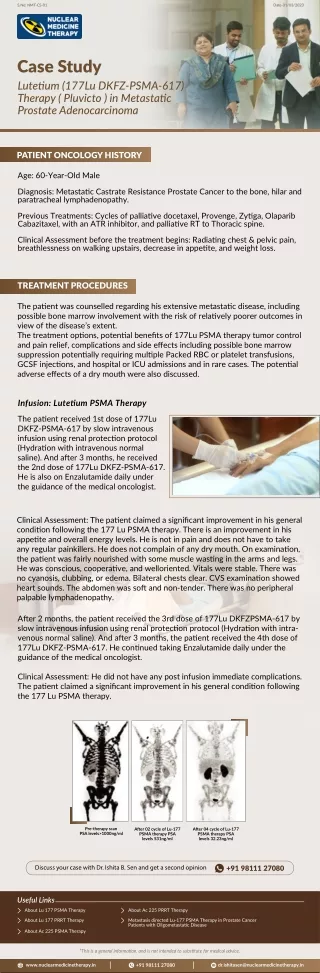 Case Study Lutetium (177Lu DKFZ-PSMA-617) Therapy ( Pluvicto ) in Metastatic Prostate Adenocarcinoma