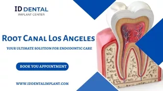 Painless Root Canal in Los Angeles | ID Dental & Implant Center