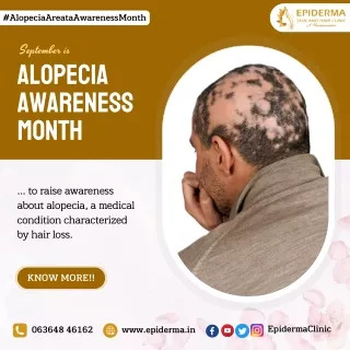 September is Alopecia Awareness Month | Hair Clinic Jayanagar | Epiderma Clinic