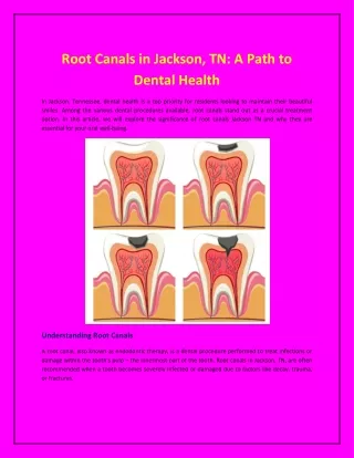 Root Canals in Jackson, TN: A Path to Dental Health