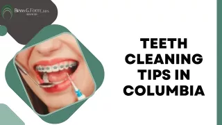 Teeth cleaning tips in Columbia