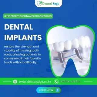 Dental Implants restores missing tooth | Dental Clinic Yelahanka | Dental Sage