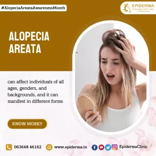 Facts about Alopecia Areata | Dermatology Centre in Jayanagar | Epiderma Clinic