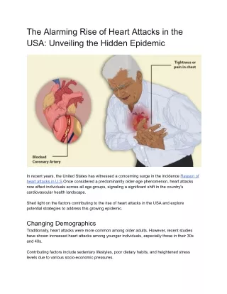 The Alarming Rise of Heart Attacks in the USA_ Unveiling the Hidden Epidemic