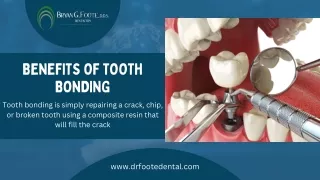 BENEFITS OF TOOTH BONDING