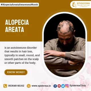 Alopecia Areata Awareness | Dermatology Centre in Jayanagar | Epiderma Clinic