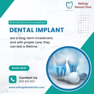 Advantages of Dental Implants | Dental Clinic in Bangalore | Nelivigi Dental