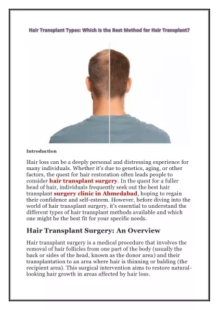 Hair Transplant Types: Which Is the Best Method for Hair Transplant?