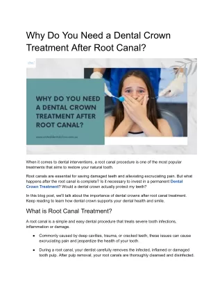 Why Do You Need a Dental Crown Treatment After Root Canal?