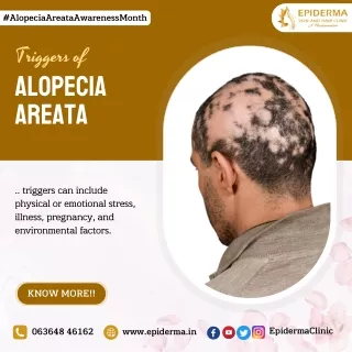 Triggers of Alopecia Areata | Best Skin Clinic in Jayanagar | Epiderma Clinic