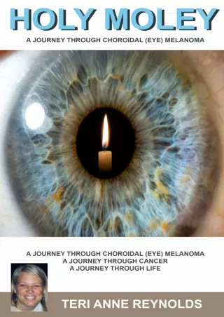 EPUB DOWNLOAD Holy Moley: A Journey Through Choroidal (Eye) Melanoma download