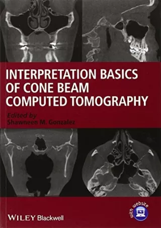 Read ebook [PDF] Interpretation Basics of Cone Beam Computed Tomography