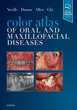 Download Book [PDF] Color Atlas of Oral and Maxillofacial Diseases