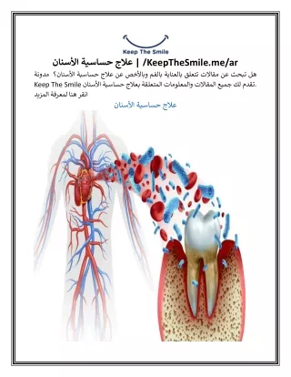 علاج حساسية الأسنان | /KeepTheSmile.me/ar
