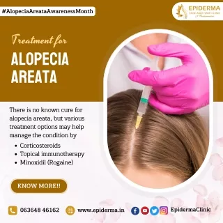 Treatment for Alopecia Areata | Dermatologist in Bangalore | Epiderma Clinic