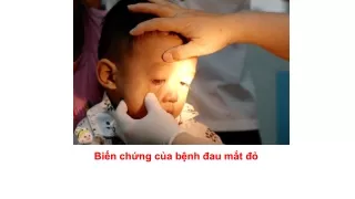 Biến chứng đau mắt đỏ