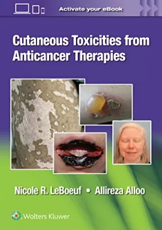 [PDF READ ONLINE] Cutaneous Toxicities from Anticancer Therapies