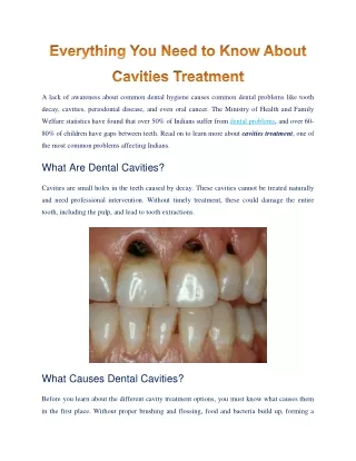 All That You Must Know About Cavities Treatment