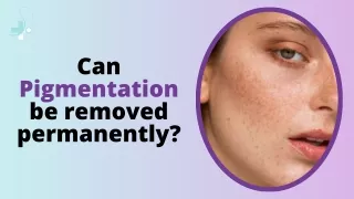 Can Pigmentation be removed naturally ?