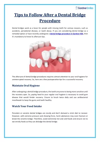 Advice to Follow for Post-Dental Bridge Procedure