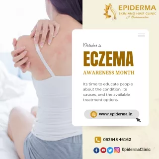 October is Eczema Awareness Month | Skin Clinic in Jayanagar | Epiderma Clinic