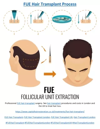 FUE Hair Transplant Process