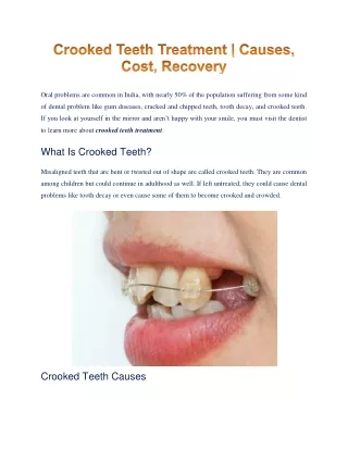 Everything You Need To Know About Crooked Teeth Treatment