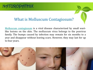 Molluscum Contagiosum Treatment