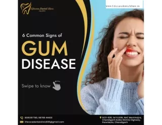 6 Common Signs of Gum Diseas | Lifecare Dental Clinic