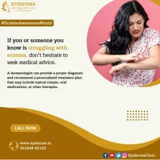 Are you struggling with Eczema | Dermatologist in Jayanagar | Epiderma Clinic