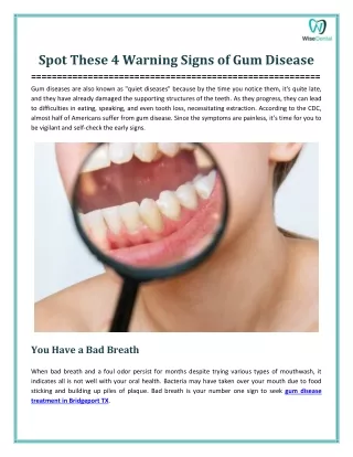 4 Signs of Gum Disease to Observe