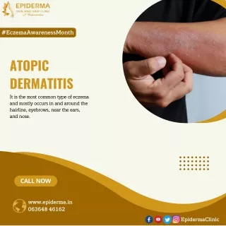 Atopic Dermatitis | Eczema Awareness Month | Epiderma Skin Clinic Jayanagar