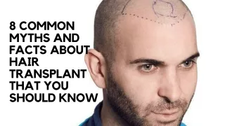COMMON MYTHS AND FACTS ABOUT HAIR TRANSPLANT