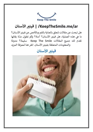 فينير الأسنان  KeepTheSmile.me ar