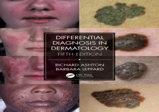 DOWNLOAD PDF Differential Diagnosis in Dermatology