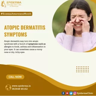 Atopic Dermatitis Symptoms | Best Skin Clinic in Jayanagar | Epiderma Clinic