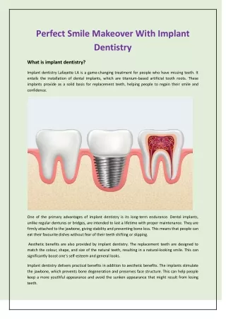 Perfect Smile Makeover With Implant Dentistry