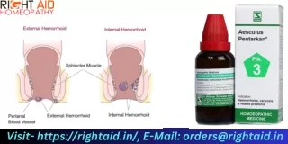 Aesculus Pentarkan Natural Relief for Varicose Veins - Discover an Effective Remedy for Vascular Health