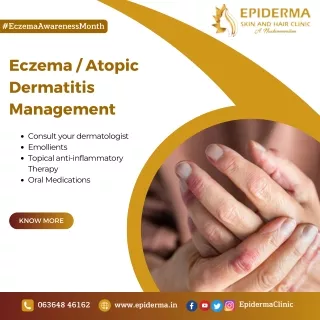 Eczema or Atopic Dermatitis Management | Skin Clinic Jayanagar | Epiderma Clinic