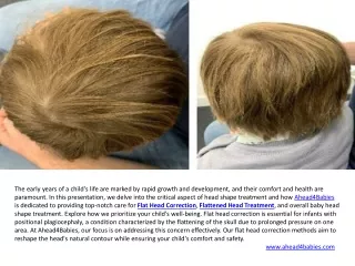 Baby Head Shape Treatment & Plagiocephaly Helmet UK