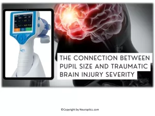 The Connection Between Pupil Size and Traumatic Brain Injury Severity