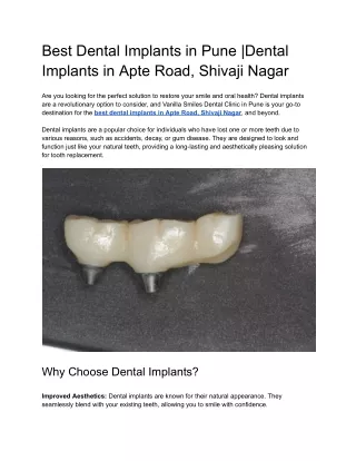 Best Dental Implants in Pune _Dental Implants in Apte Road, Shivaji Nagar