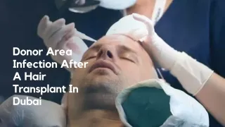 Donor Area Infection After A Hair Transplant In Dubai