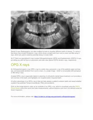 Orthopantomogram (OPG) X-Ray - Dental CT Scanning Services UK - CT Dent Ltd