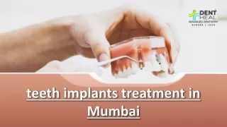 Dent Heal: Leading Teeth Implants Treatment in Mumbai