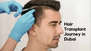 Hair Transplant Journey in Dubai